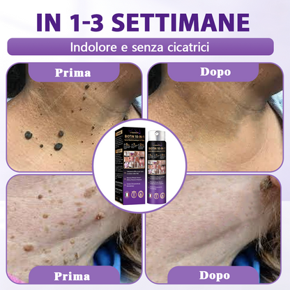 Prodotto e spedito dall’Italia ✨Evolvion® Spray Riparatore Cutaneo Biotina 10-in-1 🎉-up