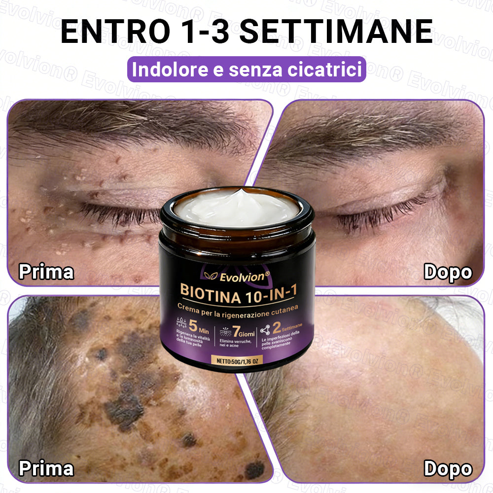 Prodotto e spedito dall’Italia ✨Evolvion® Biotin 10-in-1 Skin Restoration Cream 🌻🌻