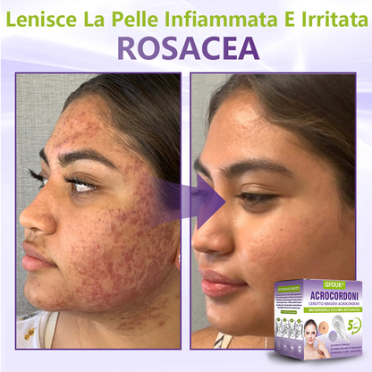 GFOUK® Cerotto con microaghi dissolvibili a base vegetale per la rimozione dei fibromi penduli🌿