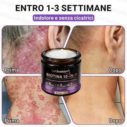 Prodotto e spedito dall’Italia ✨Evolvion® Biotin 10-in-1 Skin Restoration Cream 🌻🌻