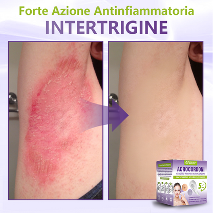 GFOUK® Cerotto con microaghi dissolvibili a base vegetale per la rimozione dei fibromi penduli🌿