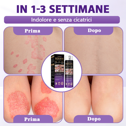 Prodotto e spedito dall’Italia ✨Evolvion® Spray Riparatore Cutaneo Biotina 10-in-1 🎉-up