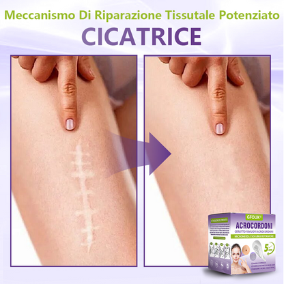 GFOUK® Cerotto con microaghi dissolvibili a base vegetale per la rimozione dei fibromi penduli🌿