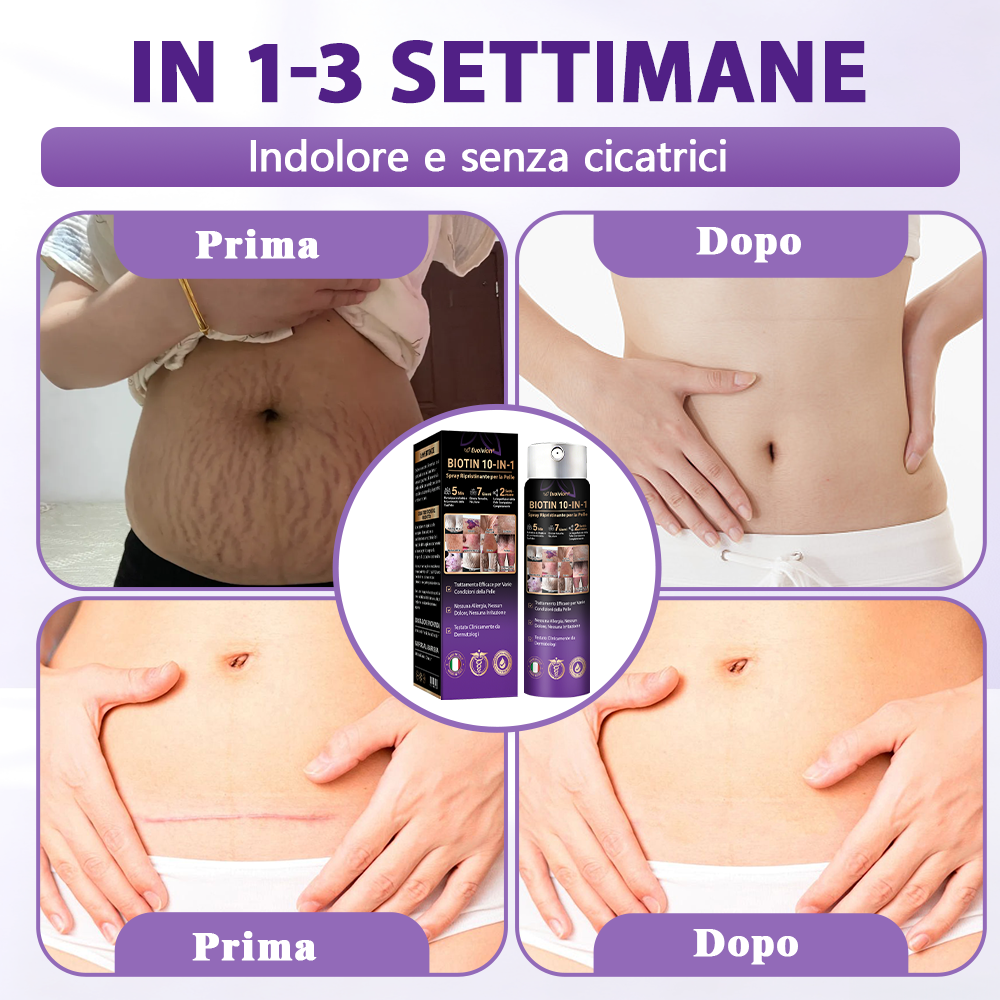 Prodotto e spedito dall’Italia ✨Evolvion® Spray Riparatore Cutaneo Biotina 10-in-1 🎉-up
