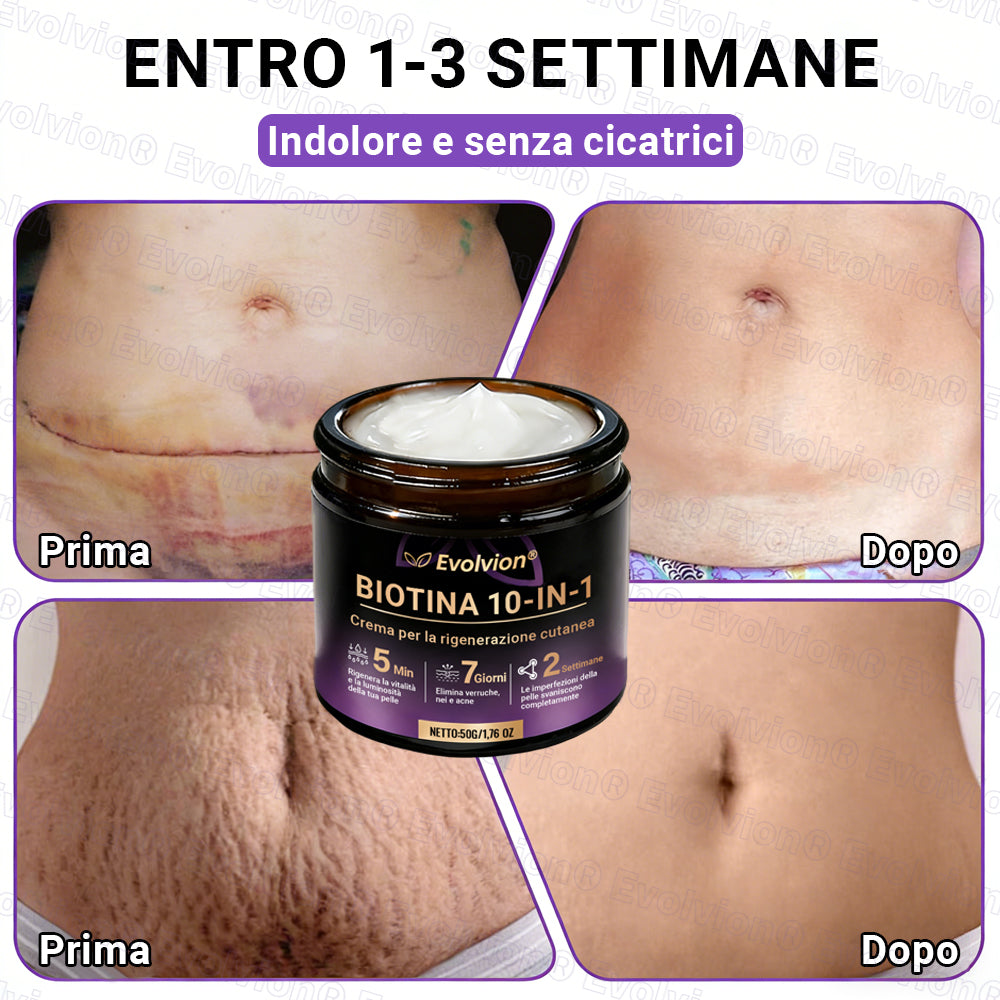 Prodotto e spedito dall’Italia ✨Evolvion® Biotin 10-in-1 Skin Restoration Cream 🌻🌻