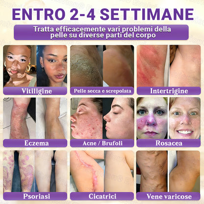 Prodotto e spedito dall’Italia ✨Evolvion® Biotin 10-in-1 Skin Restoration Cream 🌻🌻