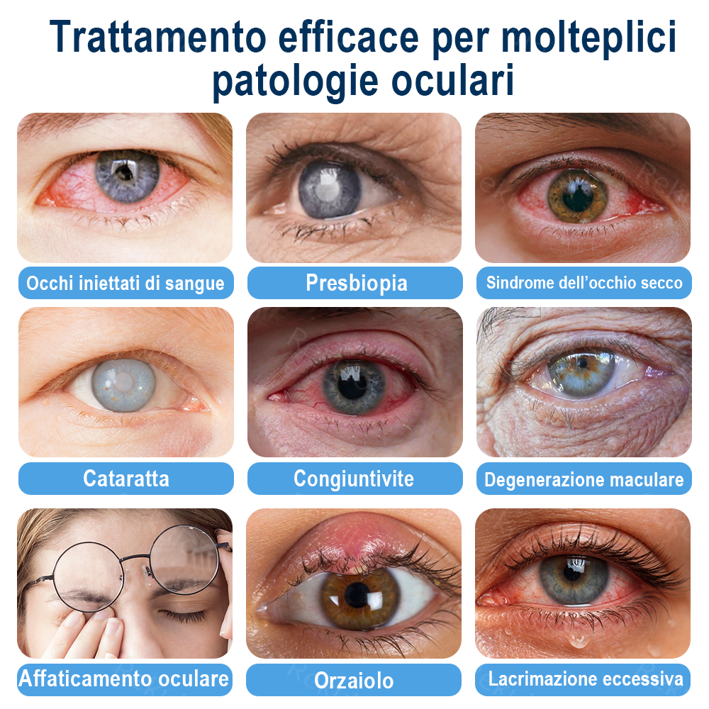 Rekulo® OptiMist Spray Oculare ✅ Per occhi secchi, visione offuscata,presbiopia e cataratta 👀