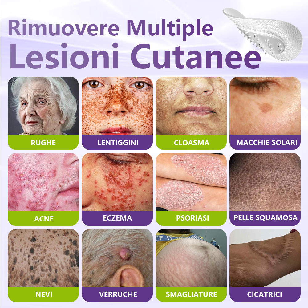 GFOUK® Cerotto con microaghi dissolvibili a base vegetale per la rimozione dei fibromi penduli🌿