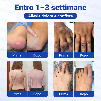 𝐎𝐟𝐟𝐢𝐜𝐢𝐚𝐥 𝐒𝐭𝐨𝐫𝐞 🇮🇹 | GFOUK® BPC-157 × NSAID Gel Antiartrite 10-in-1 a Penetrazione Rapida e Senza Oli (Tratta Artrite, Neuropatia, Reumatismi, Infortuni Sportivi e Altro) 🔥