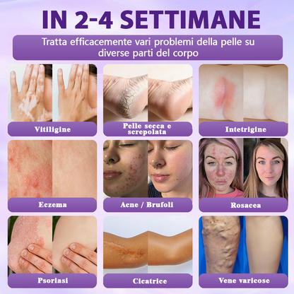 Prodotto e spedito dall’Italia ✨Evolvion® Spray Riparatore Cutaneo Biotina 10-in-1 🎉-up