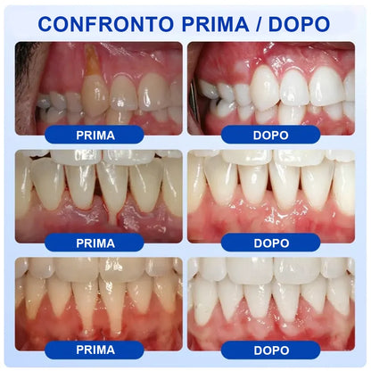 Pheromex®  GumRevive – Gel per la cura parodontale🥀💐 -up
