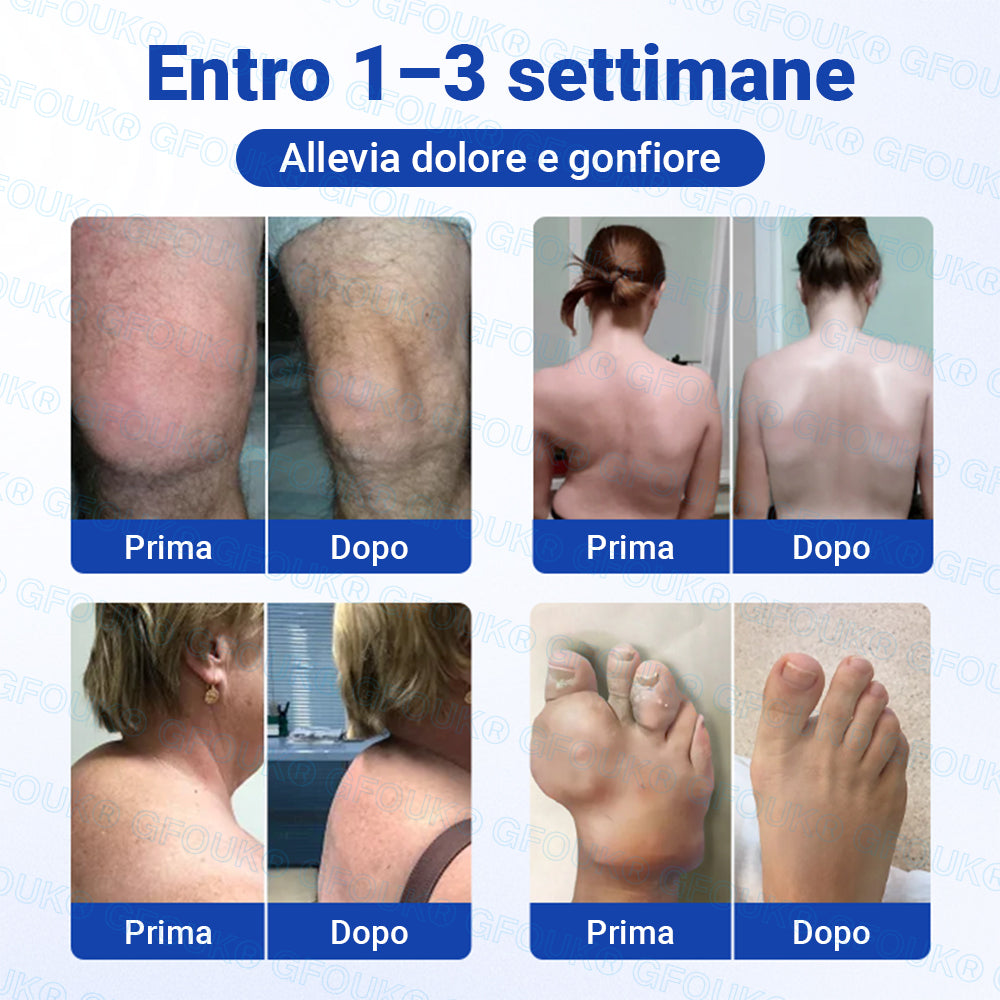𝐎𝐟𝐟𝐢𝐜𝐢𝐚𝐥 𝐒𝐭𝐨𝐫𝐞 🇮🇹 | GFOUK® BPC-157 × NSAID Gel Antiartrite 10-in-1 a Penetrazione Rapida e Senza Oli (Tratta Artrite, Neuropatia, Reumatismi, Infortuni Sportivi e Altro) 🔥