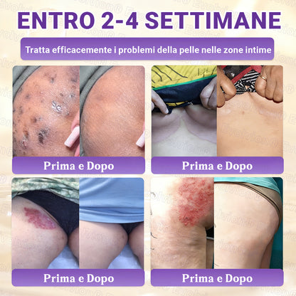 Prodotto e spedito dall’Italia ✨Evolvion® Biotin 10-in-1 Skin Restoration Cream 🌻🌻
