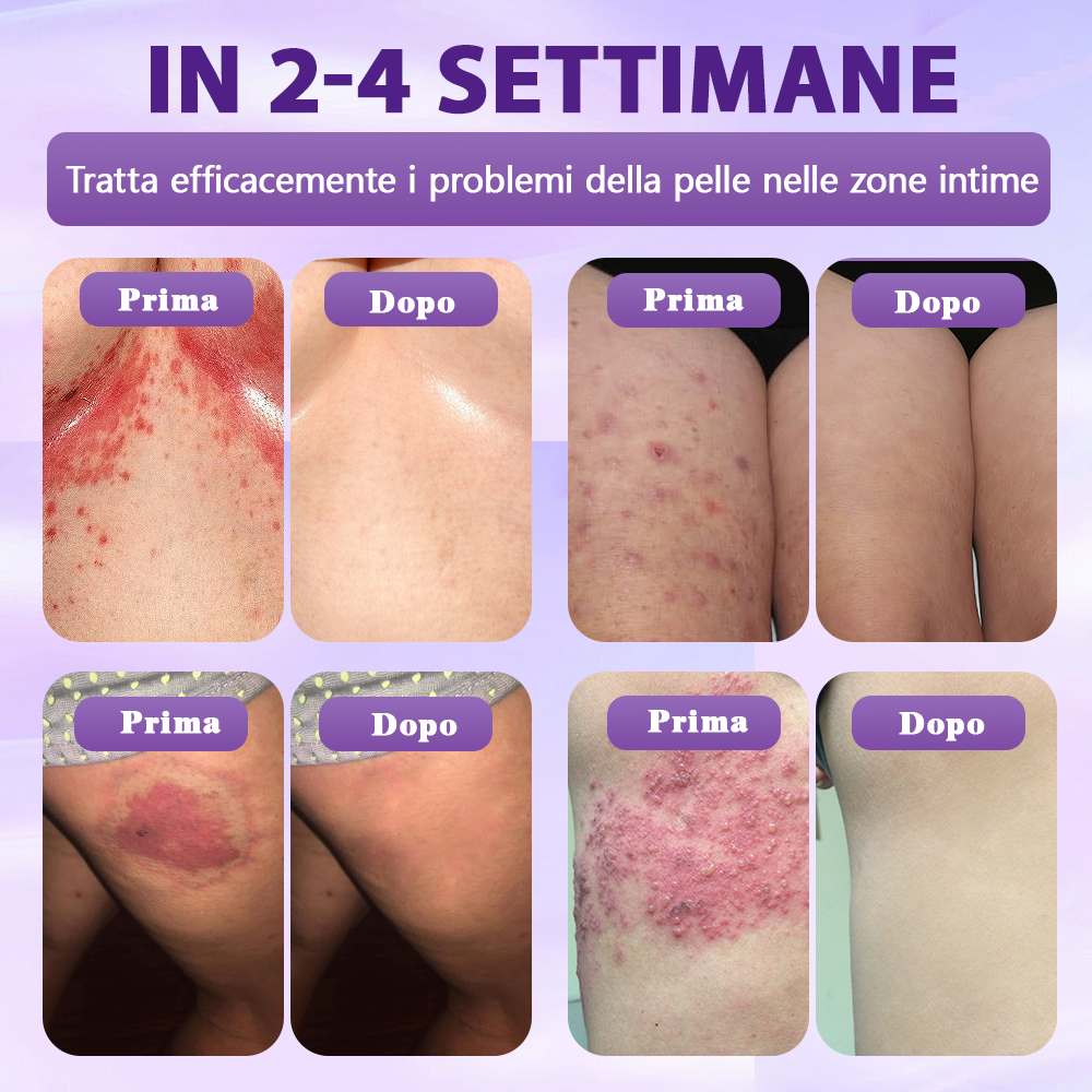 Prodotto e spedito dall’Italia ✨Evolvion® Spray Riparatore Cutaneo Biotina 10-in-1 🎉-up