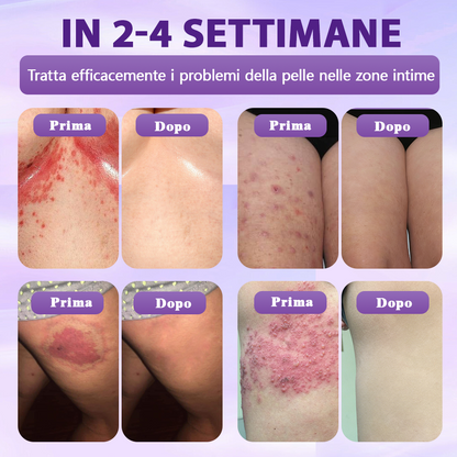 Prodotto e spedito dall’Italia ✨Evolvion® Spray Riparatore Cutaneo Biotina 10-in-1 🎉-up