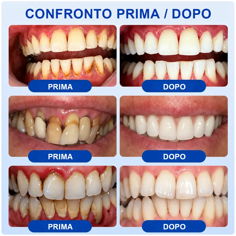Pheromex®  GumRevive – Gel per la cura parodontale🥀💐 -up
