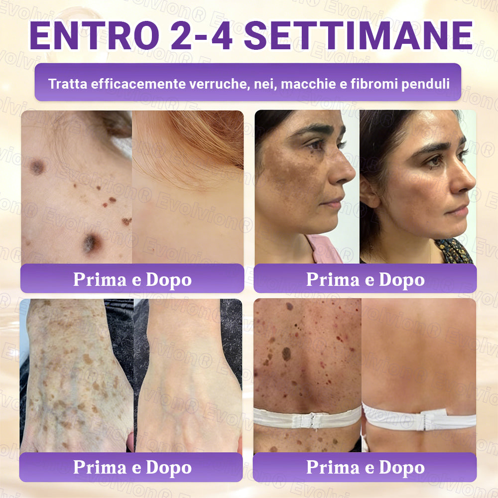 Prodotto e spedito dall’Italia ✨Evolvion® Biotin 10-in-1 Skin Restoration Cream 🌻🌻