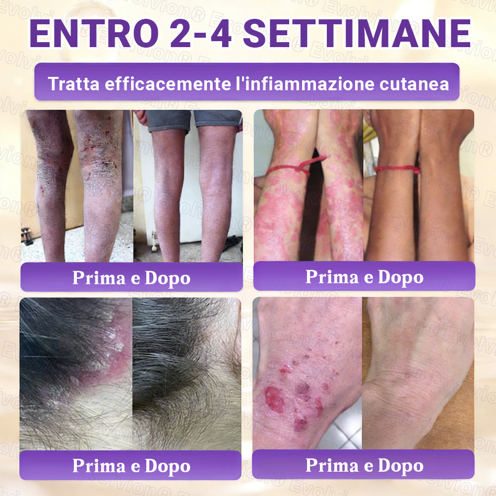 Prodotto e spedito dall’Italia ✨Evolvion® Biotin 10-in-1 Skin Restoration Cream 🌻🌻