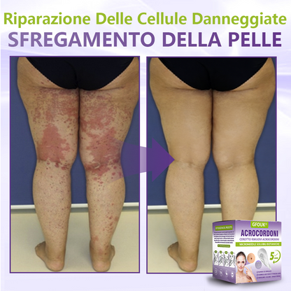 GFOUK® Cerotto con microaghi dissolvibili a base vegetale per la rimozione dei fibromi penduli🌿