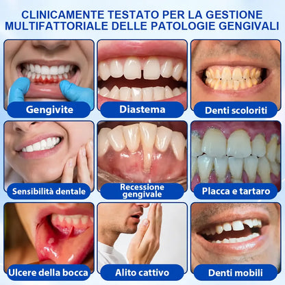 Pheromex®  GumRevive – Gel per la cura parodontale🥀💐 -up