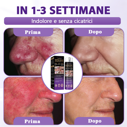 Prodotto e spedito dall’Italia ✨Evolvion® Spray Riparatore Cutaneo Biotina 10-in-1 🎉-up