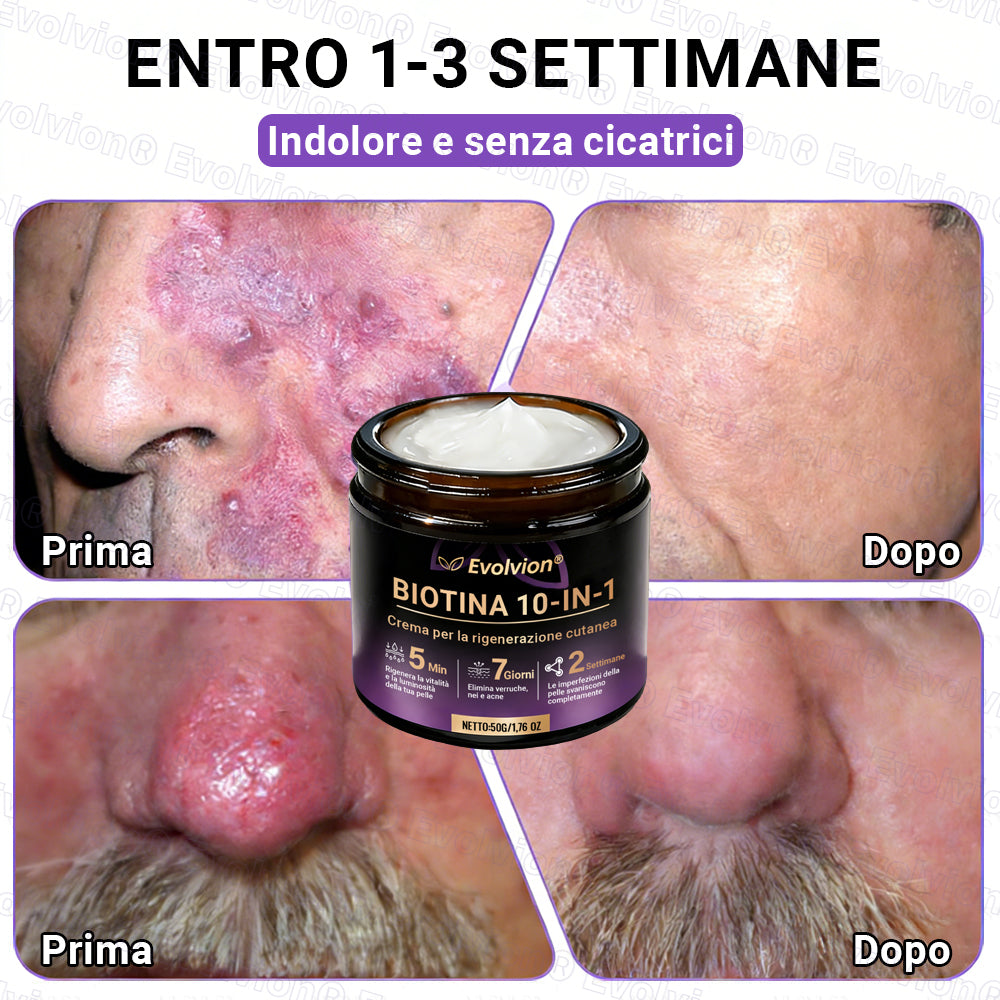 Prodotto e spedito dall’Italia ✨Evolvion® Biotin 10-in-1 Skin Restoration Cream 🌻🌻