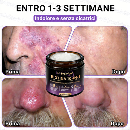 Prodotto e spedito dall’Italia ✨Evolvion® Biotin 10-in-1 Skin Restoration Cream 🌻🌻