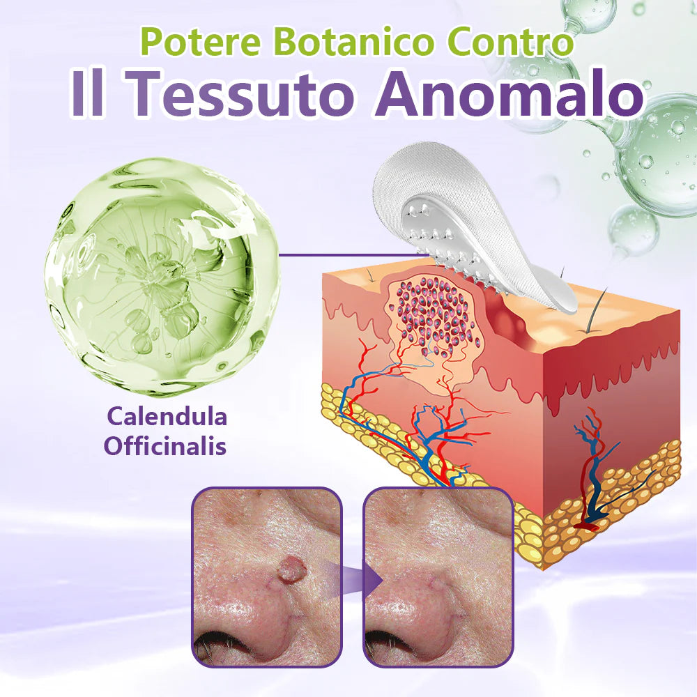 GFOUK® Cerotto con microaghi dissolvibili a base vegetale per la rimozione dei fibromi penduli🏵️