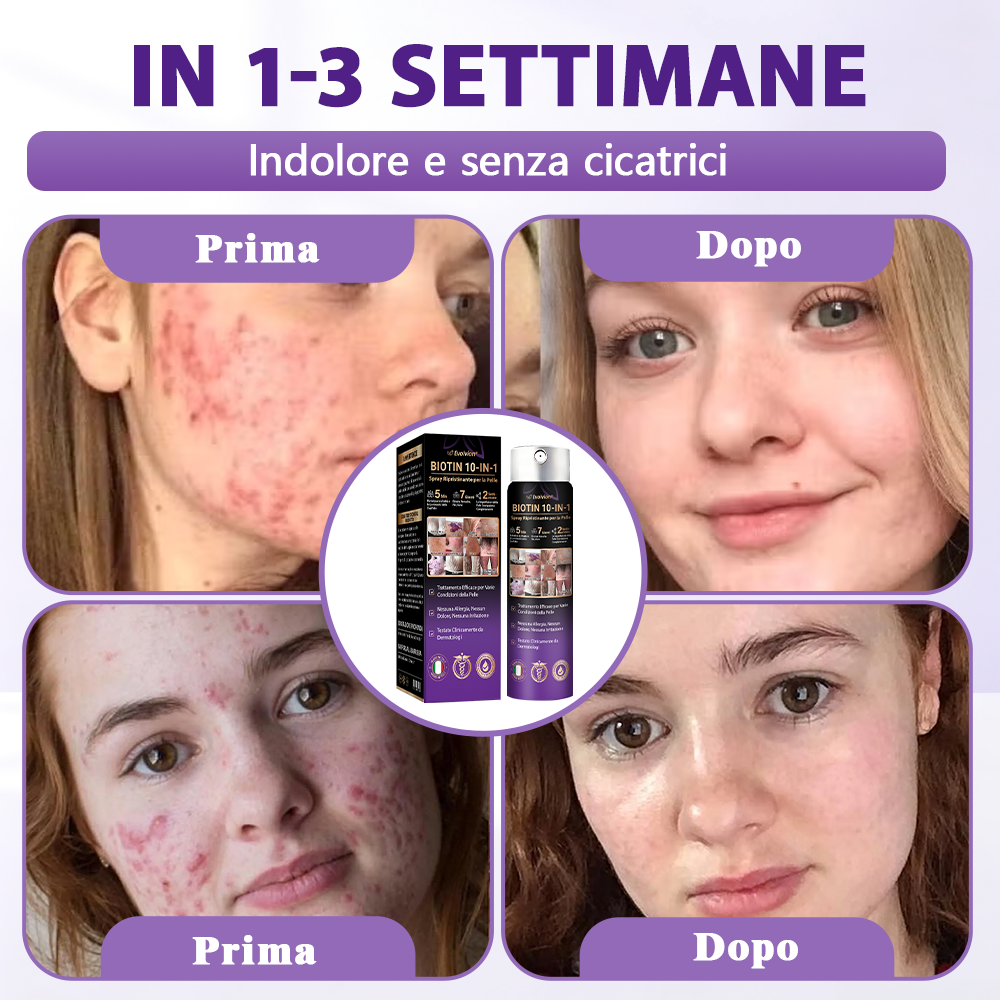 Prodotto e spedito dall’Italia ✨Evolvion® Spray Riparatore Cutaneo Biotina 10-in-1 🎉-up