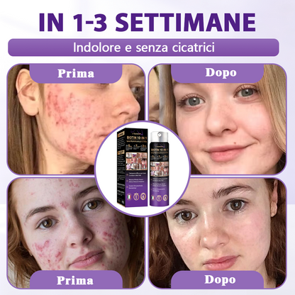 Prodotto e spedito dall’Italia ✨Evolvion® Spray Riparatore Cutaneo Biotina 10-in-1 🎉-up