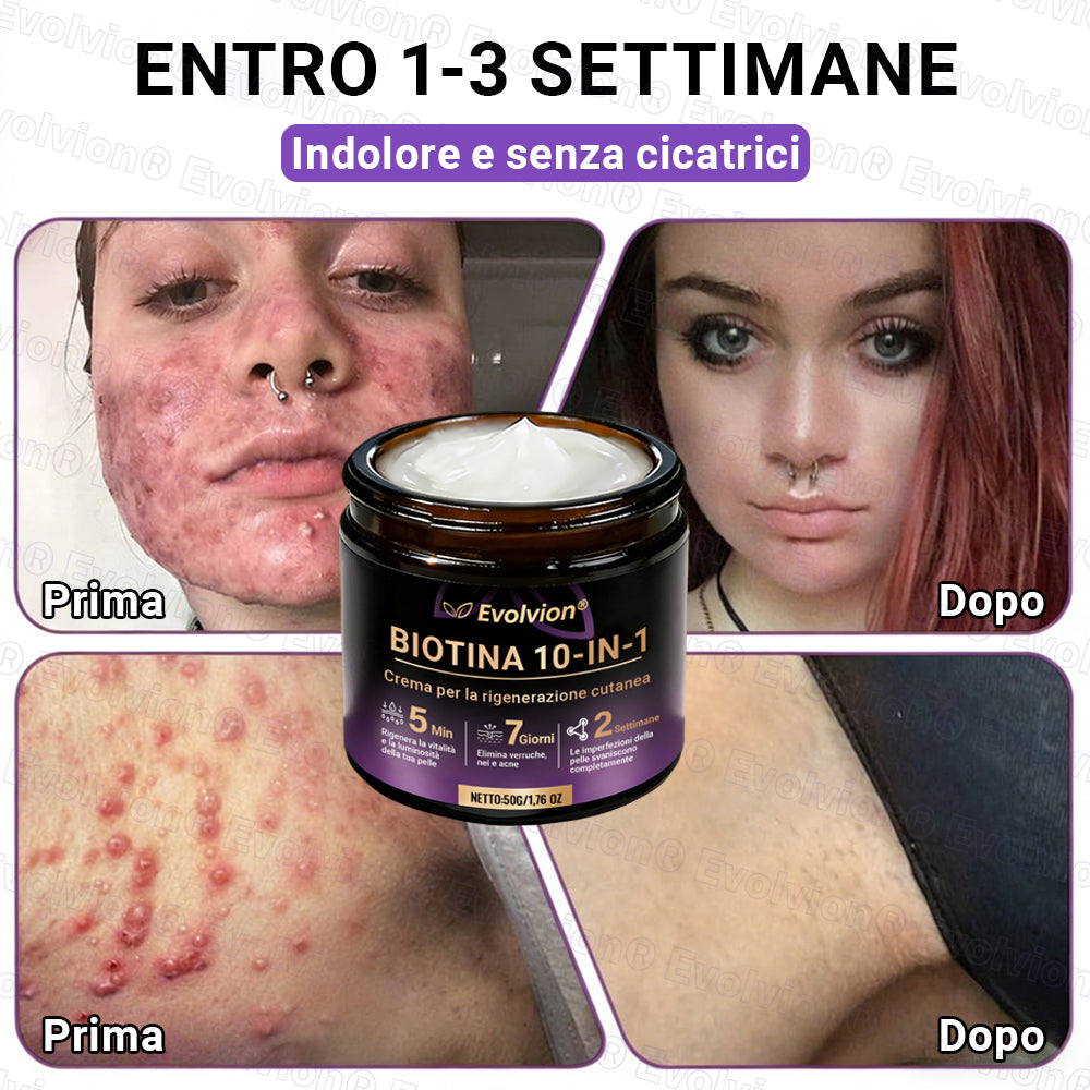 Prodotto e spedito dall’Italia ✨Evolvion® Biotin 10-in-1 Skin Restoration Cream 🌻🌻