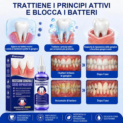 Pheromex®  GumRevive – Gel per la cura parodontale🥀💐 -up