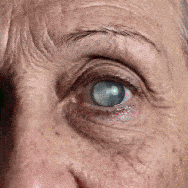 2 BOTTIGLIE 👁️ Riparazione: Elimina arrossamenti e secchezza oculare persistenti